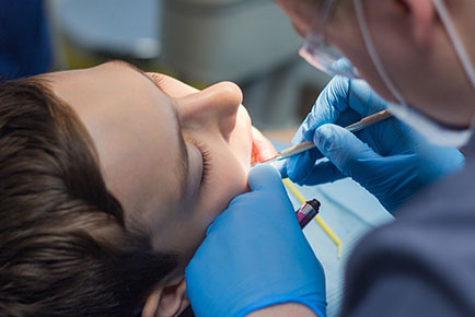 A Primer on Dental Sealants