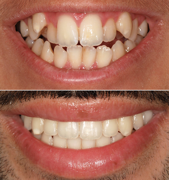 Orthodontics Before and After