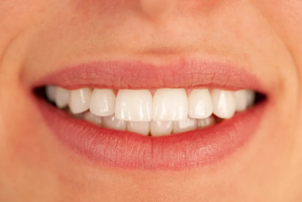 Close-up of a bright white smile