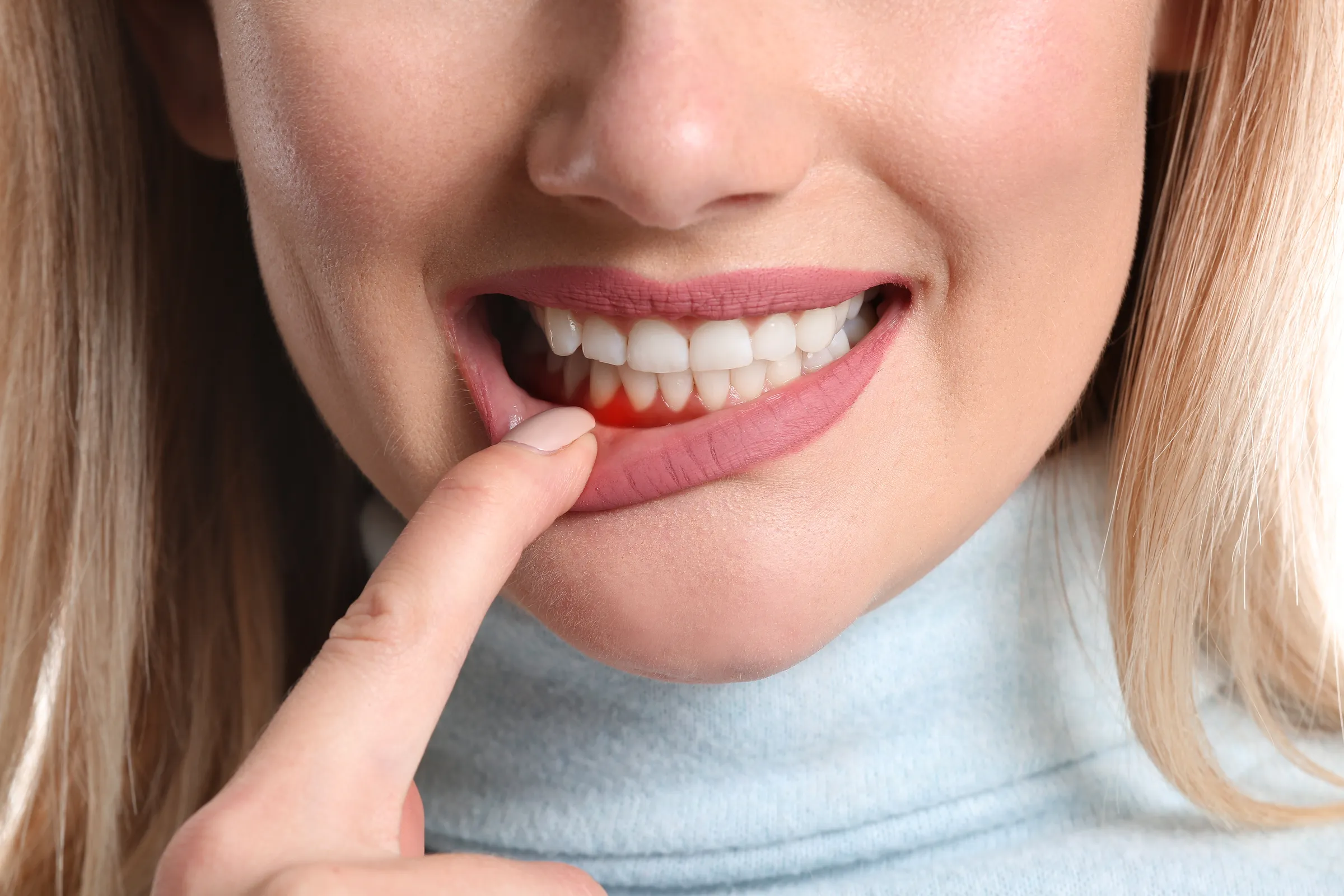 Woman pulling back her lip to check her gums