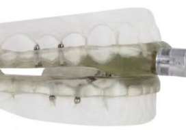 TAP 1 oral appliance
