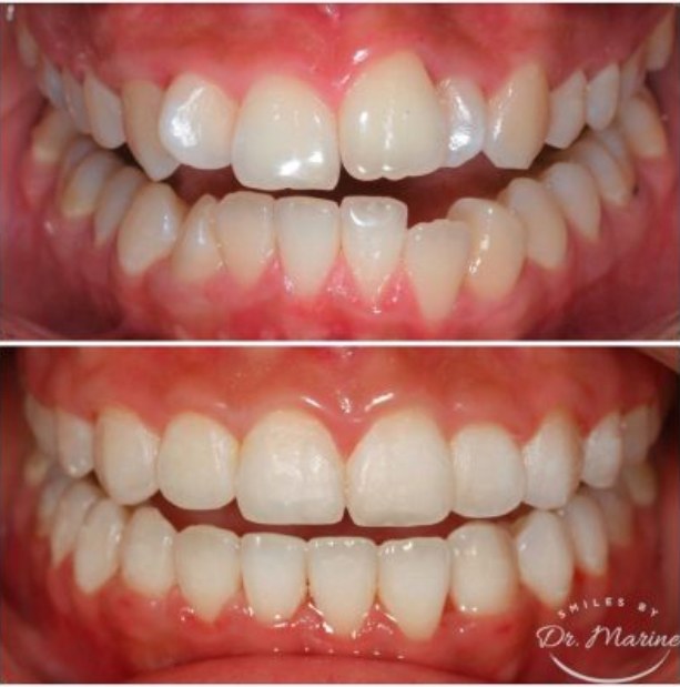 Patient case 3: before treatment (top) and after (bottom)