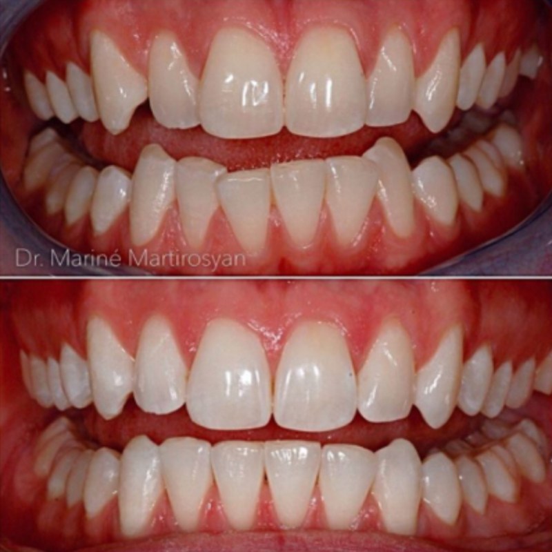 Patient case 4: before treatment (top) and after (bottom)