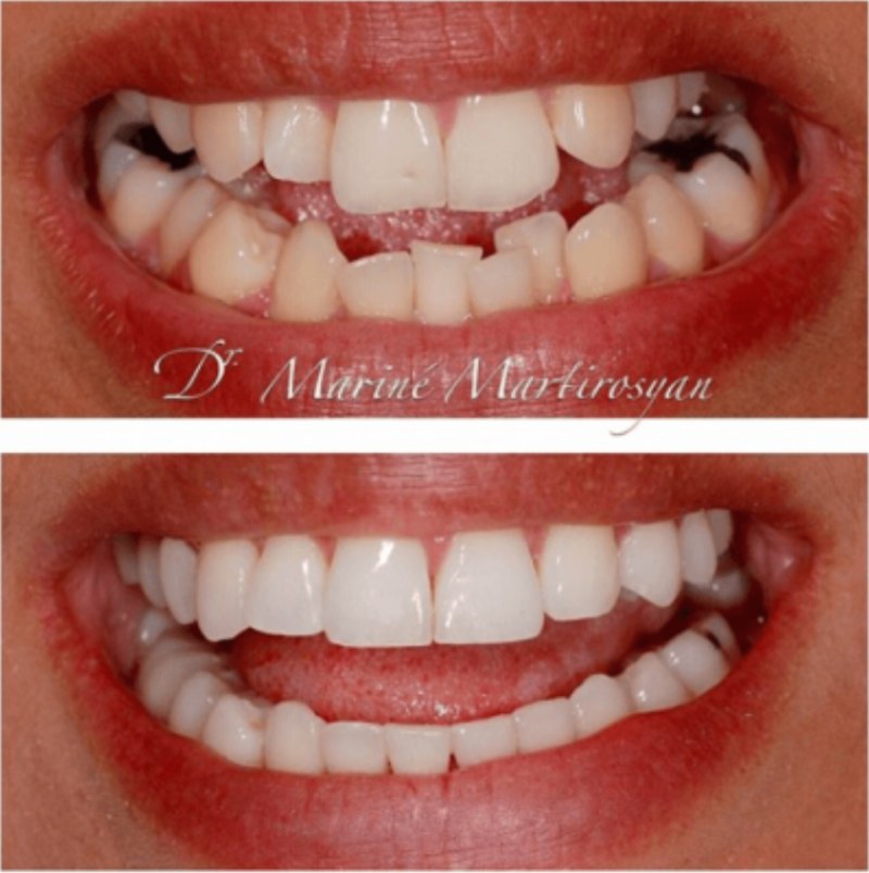 Patient case 5: before treatment (top) and after (bottom)