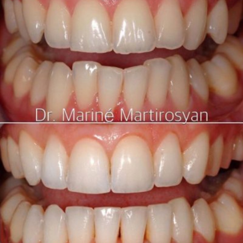 Patient case 6: before treatment (top) and after (bottom)