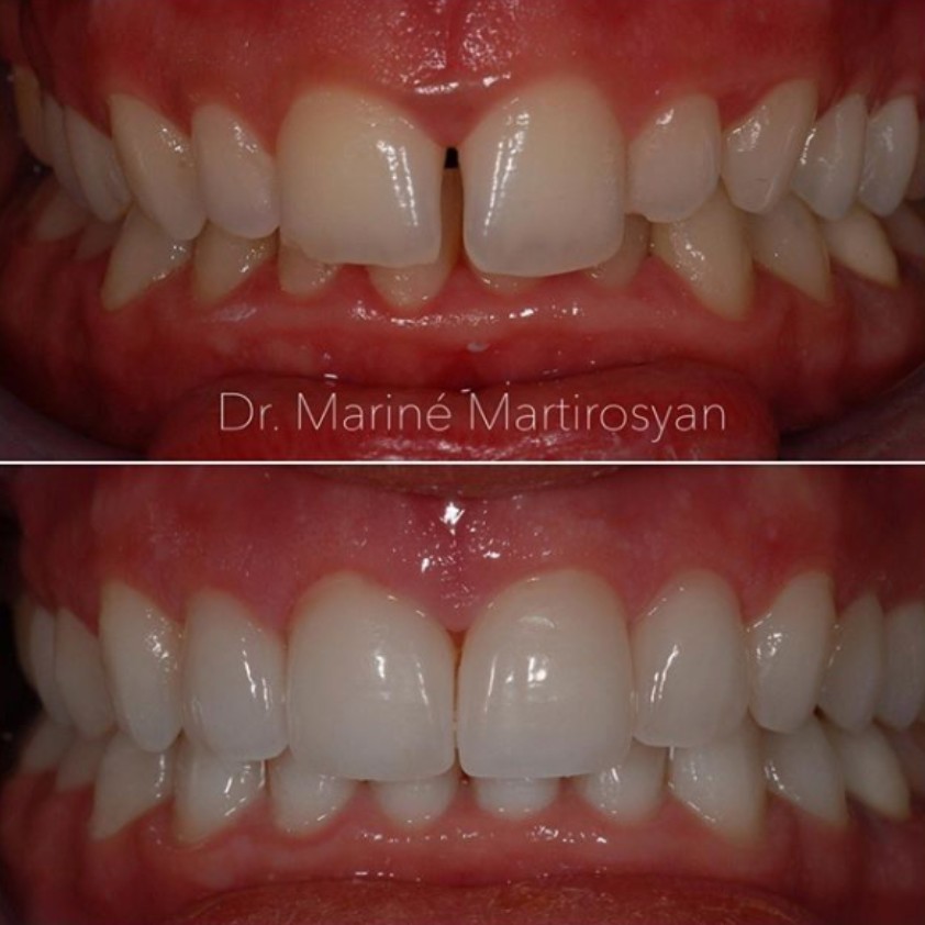 Patient case 8: before treatment (top) and after (bottom)