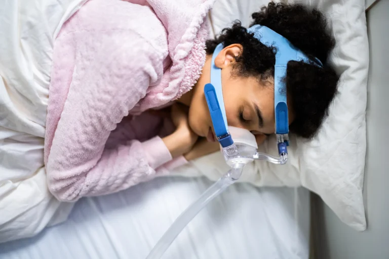 A woman asleep wearing a CPAP mask, headgear and hose
